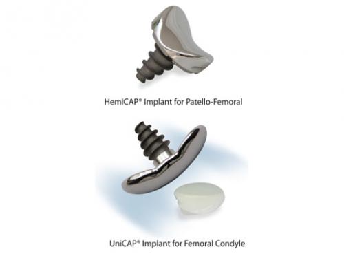 Arthrosurface knee devices: image from Arthrosurface
